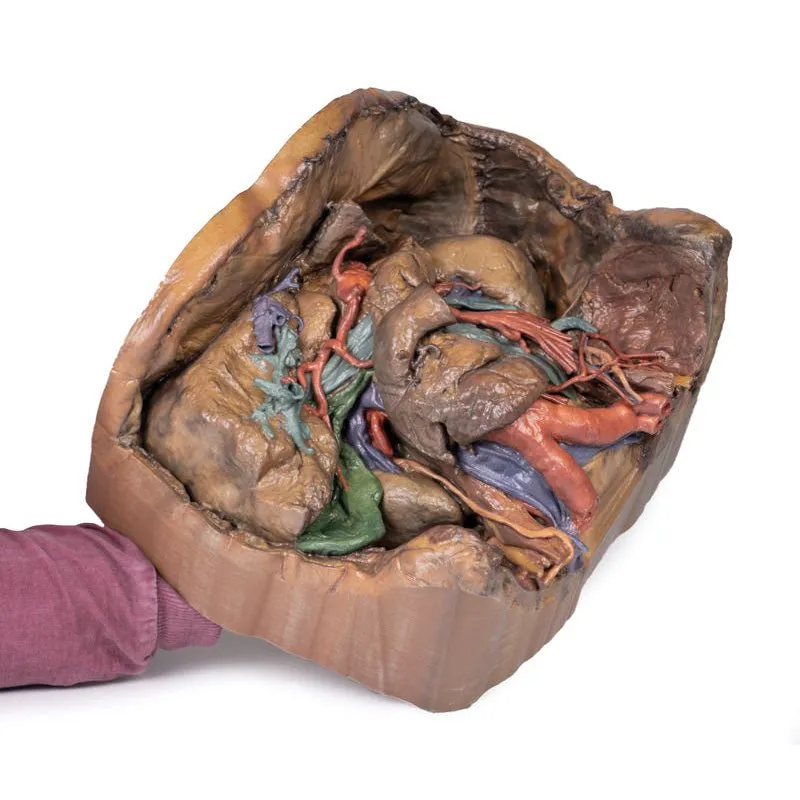 3D Printed Abdomen Vasculature