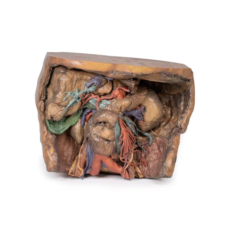 3D Printed Abdomen Vasculature