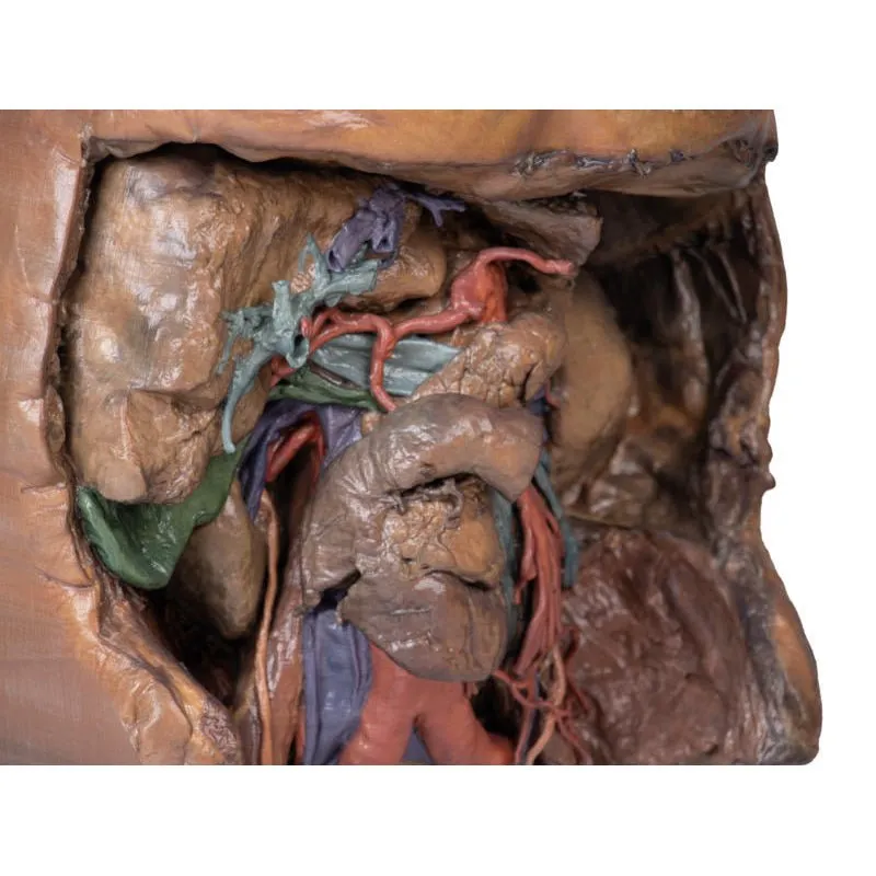 3D Printed Abdomen Vasculature